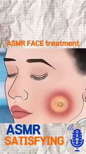 Ultimate FVE Treatment ASMR Experience