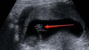 1M views · 431 reactions | Scientists discovered something 'shocking' that could rewrite a key part of human evolution. | Insider Tech | Facebook