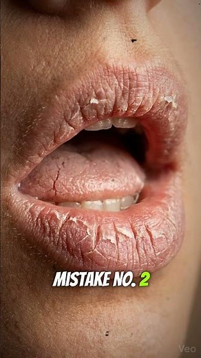 Why You Wake Up with a DRY Mouth (Stop Doing This!)
