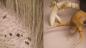 Sickening simulation ‘unlocks new phobia’ after showing why nits make your head itchy