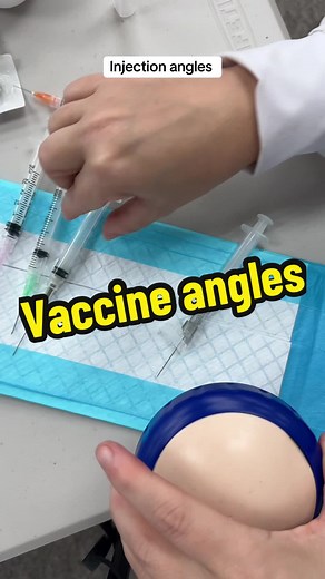 Mastering Injection Angles for Different Types of Injections
