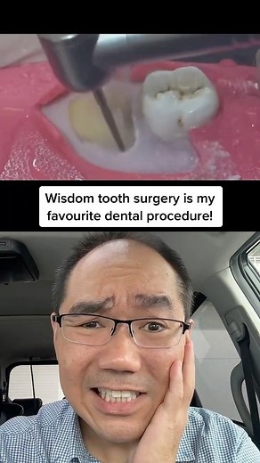 40K views · 3.4K reactions | My favourite dental procedure in the...