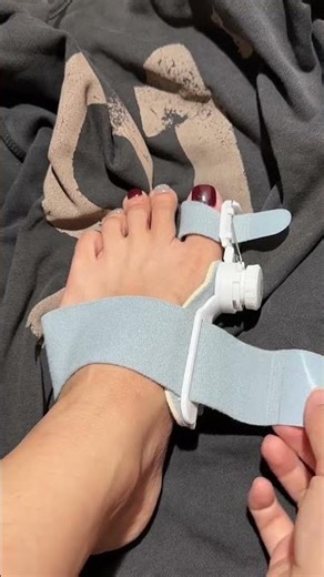 Foot Care Toe Alignment Strap 👣 | Daily Wear, Visible Results