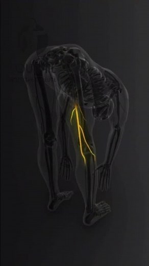 Sciatica Pain: Causes, Symptoms, and Effective Relief Tips