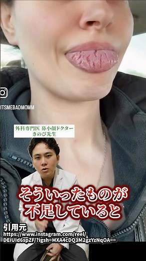 ベロが割れる！溝状舌って知ってますか？#整形 #美容 #脂肪吸引注射 #鼻整形 #鼻中隔延長 #小顔 #脂肪吸引