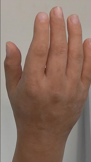 Technology to Create Prosthetic Hands So Sophisticated they are Indistinguishable from Real Hands