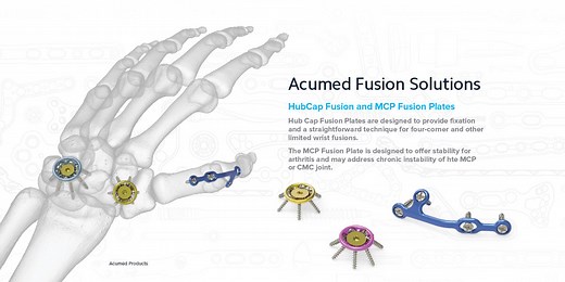 Hand Solutions – Fusions