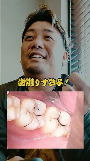 A dentist explains how to treat cavities in the grooves of teeth! [Dentist]