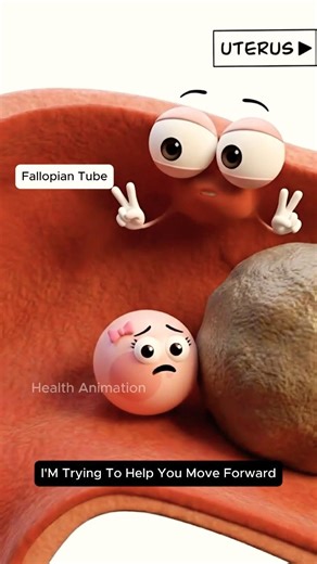 How Endometriosis Can Block the Fallopian Tube | Fertility Explained