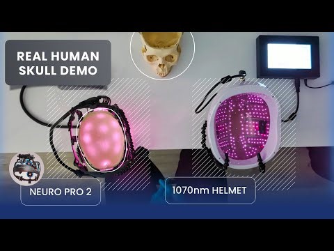 Vielight Neuro vs 1070nm Helmet | Real Human Skull | Qualitative Comparison #810nm #1070nm