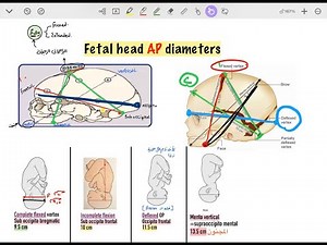 Fetal head diameters