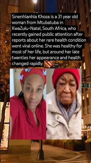 Her Life Changed Suddenly: The Story of Sinenhlanhla Khoza #viralstory #southafrica