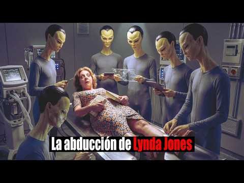 Lynda Jones: Embarazo inexplicable, implante alienígena y años de contacto | Toro del Cielo
