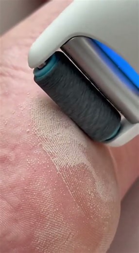 Electric Foot Sander Transformation | Rough to Smooth 4K” #satisfying #skincare