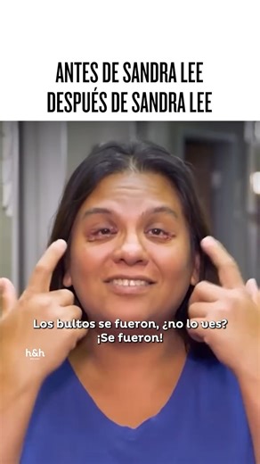 Discovery Home & Health on Reels