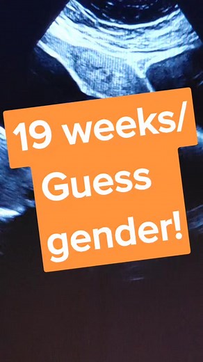 19-Week Ultrasound: Gender Reveal and Baby Yawning