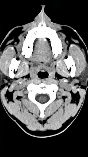 What happens to your brain when you’re stressed? | ‪@HappyLearningENG‬