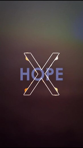 8D Music: Xxxtentacion - Hope (Best Headphone Track)