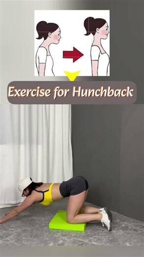 Super Exercise for Round Shoulder, Hunchback and Neck Forward #weightloss #shoulderworkout #exercise