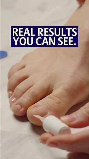 Kerasal Clear & Defend Fungal Nail Renewal: Invisible Protection, Real Results #nailfungus