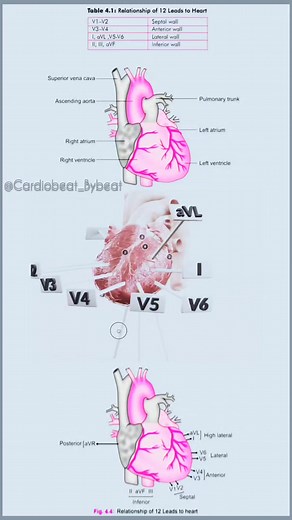 🎯The 12-Lead ECG & the Heart 🫀 🔹V1-V2: Look for septal changes. 🔹V3-V4: Detect issues in the anterior wall. 🔹I, aVL, V5-V6: Evaluate the lateral wall. 🔹II, III, aVF: Assess the inferior wall. #Cardiology #ECG #MedicalEducation #healthandwellness #HeartHealth ❤️ | Abdallah Othman