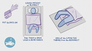 Video: Genitourinary: Removing indwelling catheters - Video Explanation! | Osmosis | Osmosis