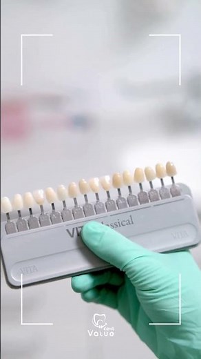 a1 vs b1 tooth colors, how to choose? #smiles #smilemakeover #dentalclinic #veneers