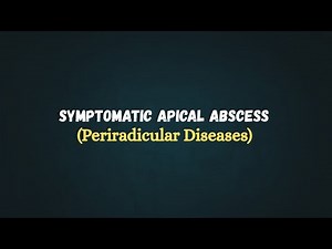 Symptomatic Apical Abscess | Endodontics | BDS Final Year