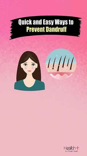 Quick and Easy Ways to Prevent Dandruff #dandruff #hair #health | Health