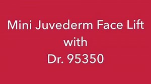 Mini Juvederm Face Lift with Dr. 95350