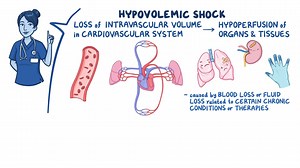 Video: Shock - Hypovolemic: Nursing - Video Explanation! | Osmosis | Osmosis