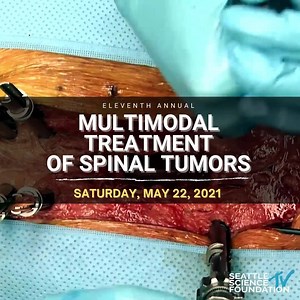 All are welcome to attend the 11th Annual Multimodal Treatment of Spinal Tumors Course. This year's course will focus on the diagnosis and multidisciplinary management of patients with metastatic spine tumors. Experts in neurosurgery, radiation oncology, neuro-oncology, medical oncology, pain management, and radiology will explore the multimodal management of primary and metastatic spinal tumors. ​ ​1. Register for FREE Webinar(https://tinyurl.com/ssfspinetumorslive). 2. Subscribe to the SSFTV c