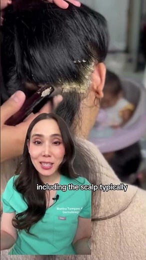 Derm Reacts to Scaly Scalp
