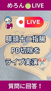 オペ看めろん🍈 on Instagram: "膵頭十二指腸切除(PD)って、どんな風に切ってるの!? ライブで実演解説👍✨ 【今回のライブでの解説ポイント】 ①PDって、なんでこんなに沢山の臓器を取らなきゃいけないの？ ②実際にどんな風に切除してるの？"