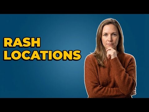 Where Do Lupus Rashes Typically Appear?