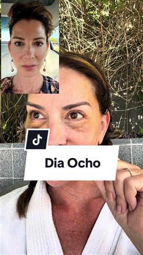 Facelift Update: Day 8 Progress