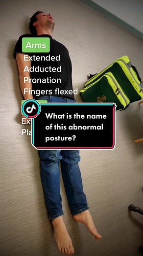 Identifying Abnormal Posture: Medical Quiz