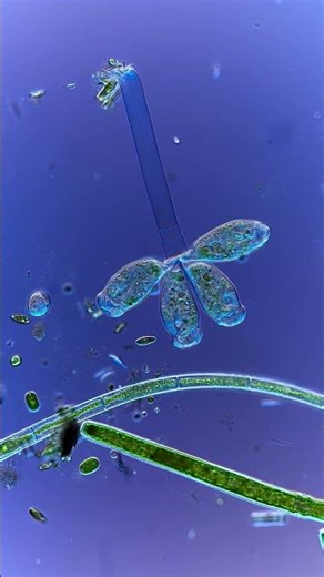 Delphi-X Observer and the power of Differential Interference Contrast (DIC) microscopy!