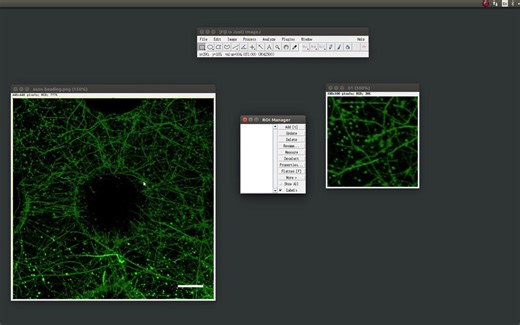 [ImageJ][油管搬运]ImageJ测算神经元轴突串珠样改变