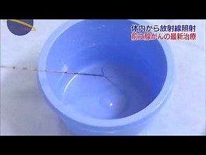 治る最前線「前立腺がんの最新治療」