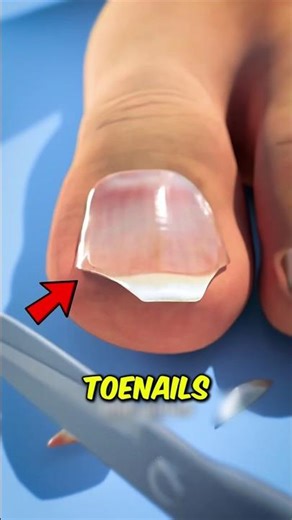 Stop Cutting Your Toenails Like This