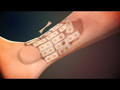 Living skin substitutes