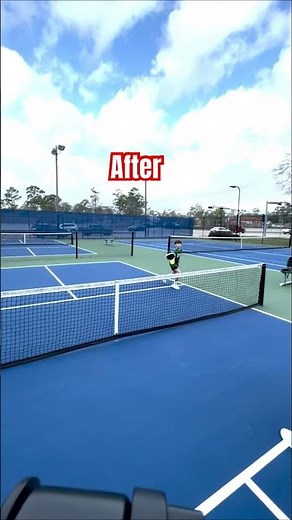 Mastering Pickleball Backhand Dink Techniques