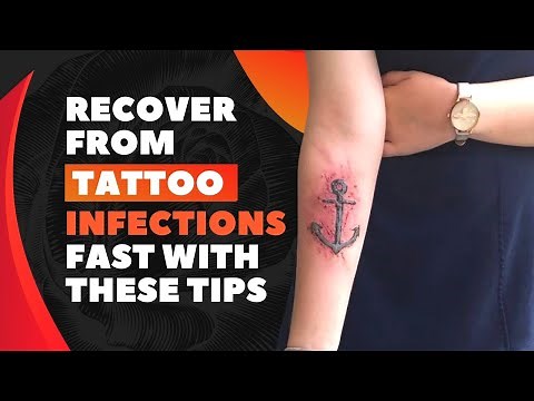 Why Your Tattoo Got Infected | Tattoo Infection Care Tips 2021