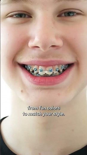 What Do Power Chains on Braces Do? 🤔 | How They Close Gaps & Speed Up Treatment