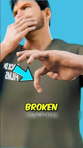 Cracking Knuckles Causes Arthritis MYTH 😳