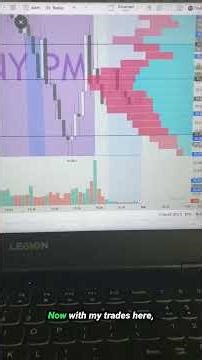 Volume Profiles Are the new Meta!?! #shorts #daytrader #priceaction #makemoneyonline #lifestyle