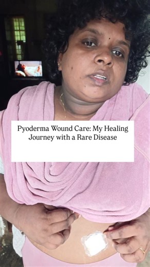 saranya Murukesan |chronic illness warrior | 📍Pyoderma Wound Care: My Healing Journey with a Rare Disease✨ . . . . . . . . . . . . . . . . . . . . . . (Motivational, motivation,... | Instagram