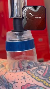 🏆 Cupping Therapy Cupping—also called myofascial decompression—uses gentle suction to lift the skin and underlying fascia, increasing blood flow and easing tension in tight muscles. This negative pressure effect helps loosen restrictions that build up from posture, training, or stress. Many people use cupping for recovery after workouts, to relieve neck and back stiffness, or simply to improve mobility. The round marks left behind aren’t bruises but signs of increased circulation, and they typi