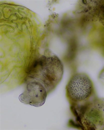 TED Talks | These creatures might look like tiny aliens on a faraway planet — but they’re actually part of a microscopic universe right here on Earth.... | Instagram